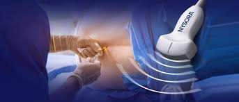 Regionális érzéstelenítés