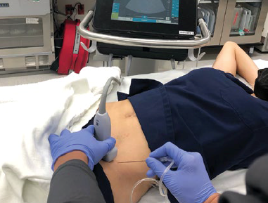 Mit jelent a regionális anesztézia?